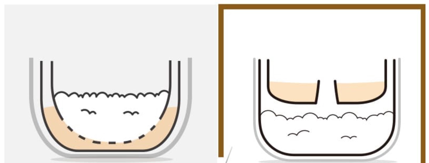 혈당 저당밥솥 다이어트