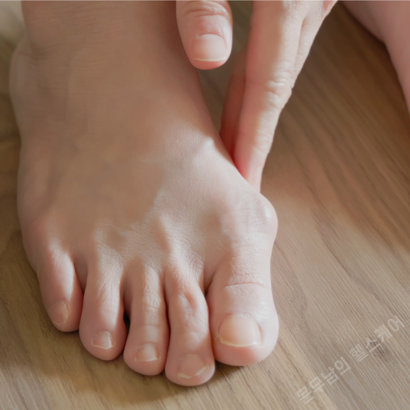 발가락 통증 원인