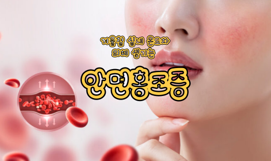 실내외 온도차가 심한 계절에 심해지는 안면홍조증