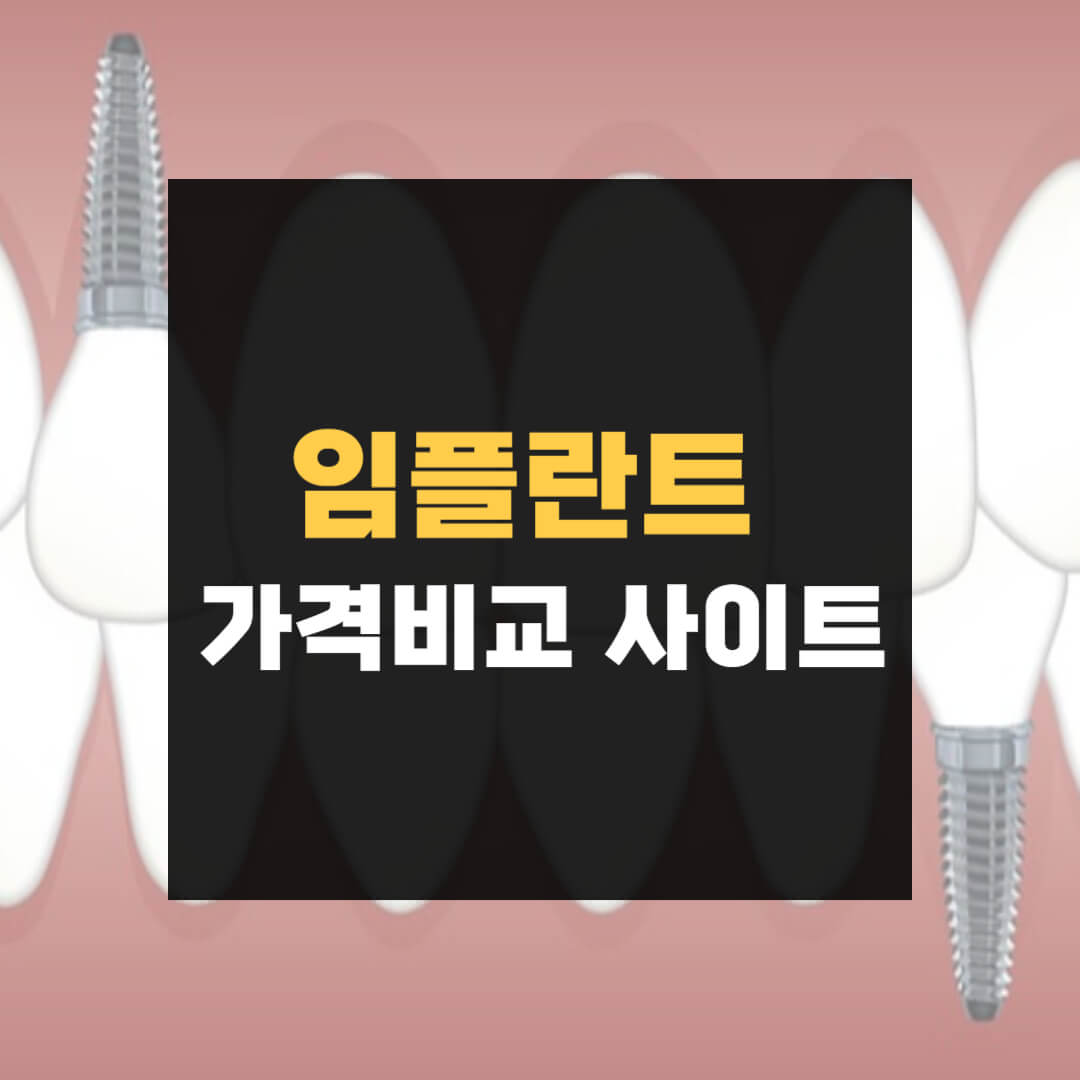 임플란트 가격비교