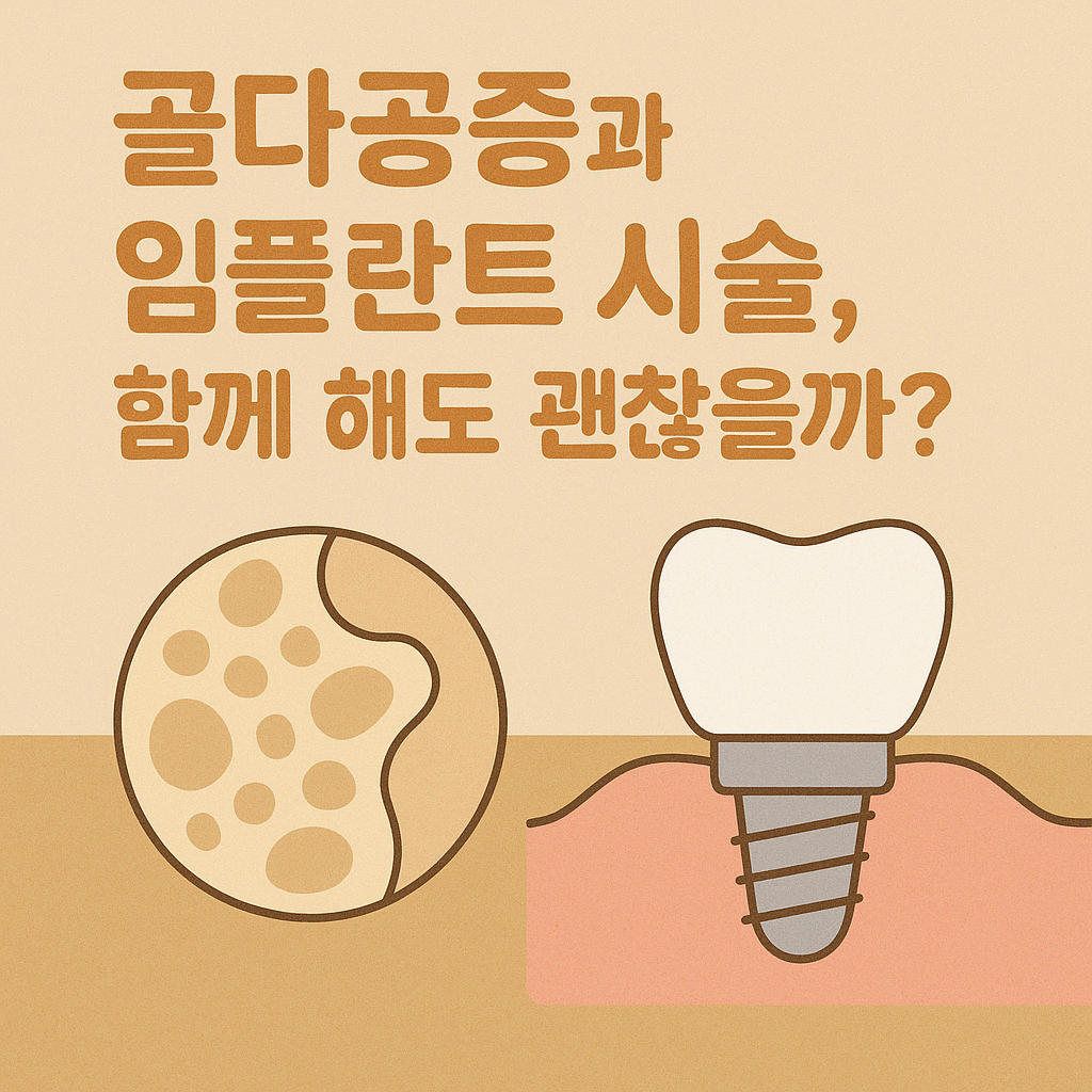 골다공증과 임플란트 시술, 함께 해도 괜찮을까?