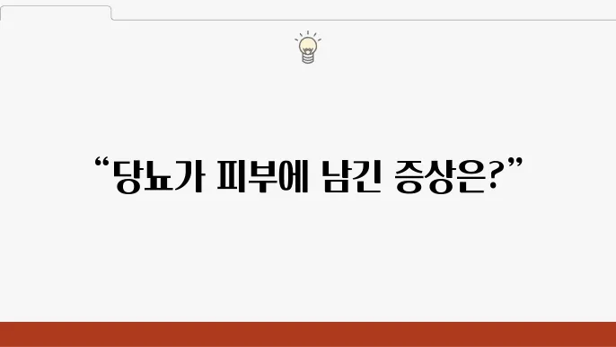 쥐젖 닸뇨 인슐린저항성 피부에 나타나는 증상