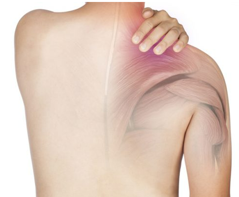 어깨 통증 원인