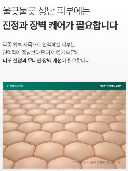 손상된-피부를-케어해야하는-이유를-보여주고-있습니다.