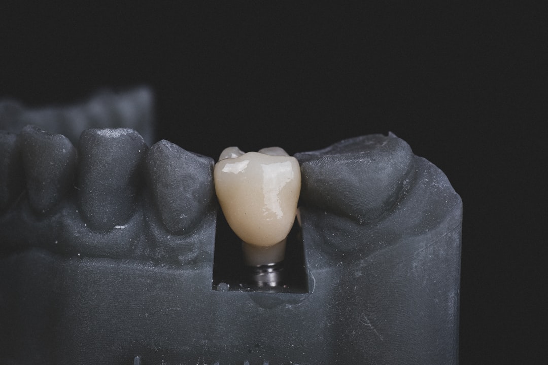 Jaw surgery