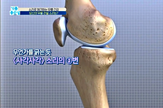 무릎에서 사각사각 소리 나는 이유, 앉았다 일어나면 무릎에서 소리가 나요, 무릎에서 소리나고 통증, 건강 팁줌 매일꿀정보