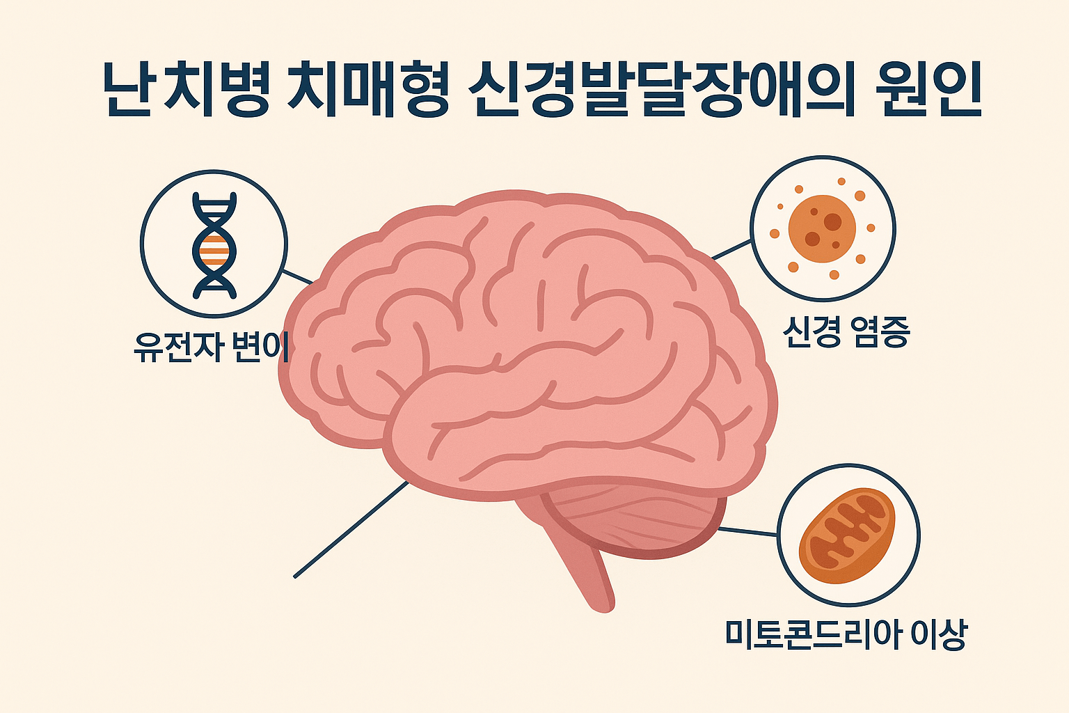 치매형 신경발달장애