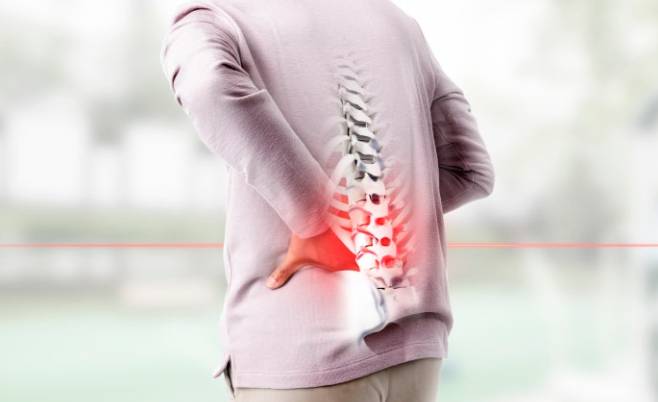 맥켄지 운동: 허리 통증, 왜 '맥켄지'여야만 하는가?