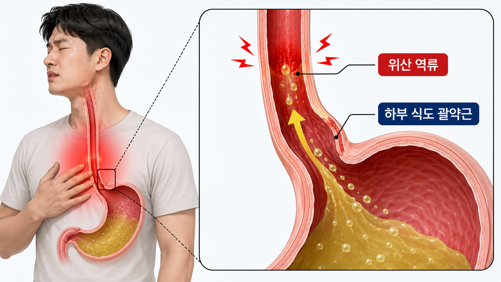 밥 먹고 나서 목이 타는 느낌,대부분 여기서 시작됩니다