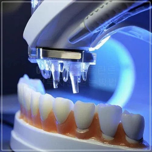 65세이상 임플란트 정부지원 신청절차4