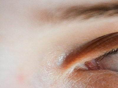 루테인 관련 사진13