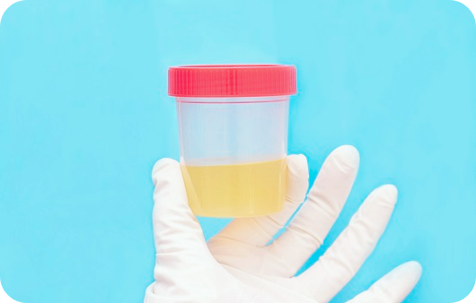 간수치가-높으면-나타나는-증상