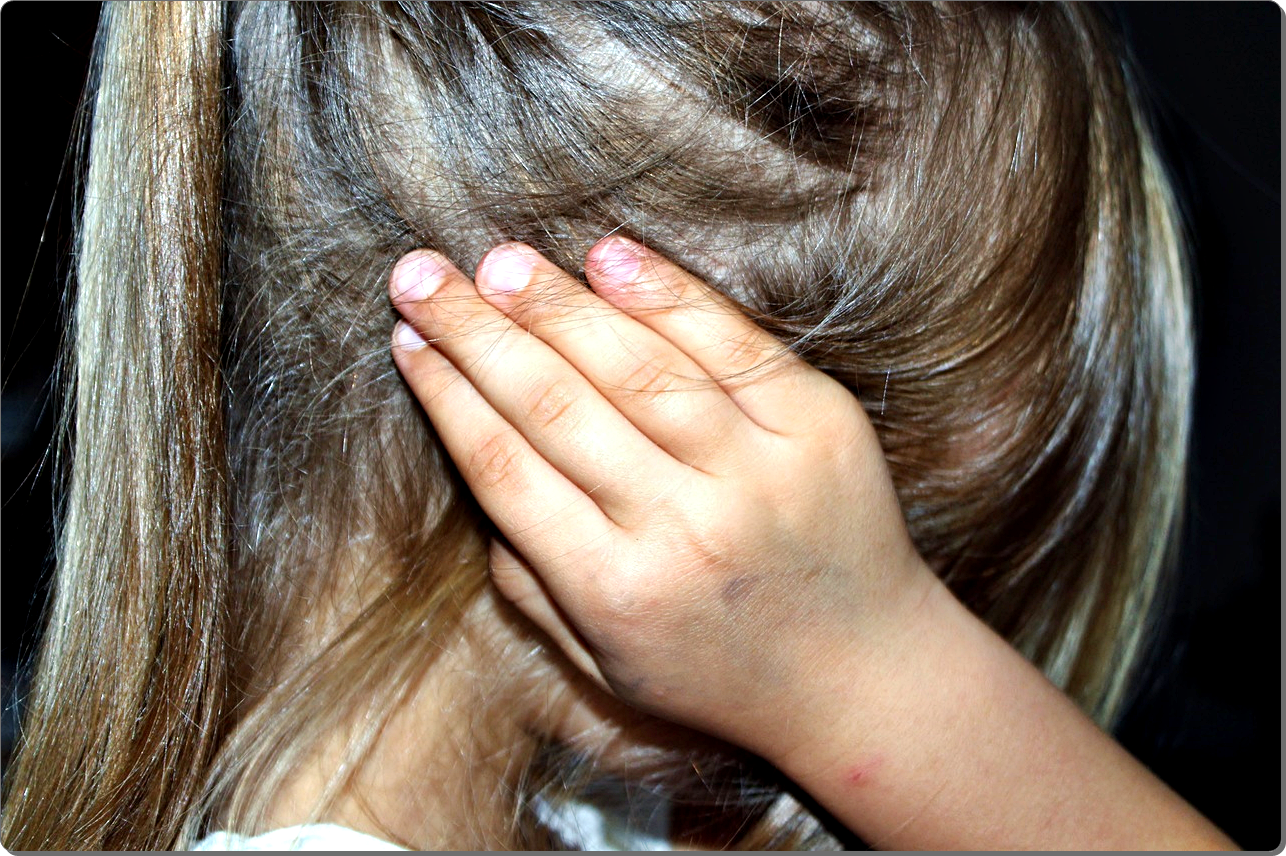 대상포진 초기증상 23