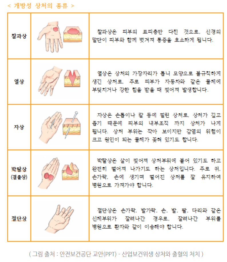 개방성-상처의-종류