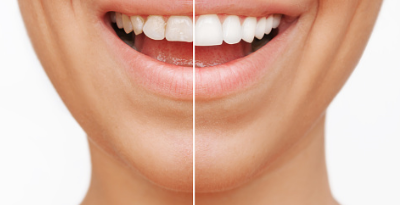 프로폴리스 효능