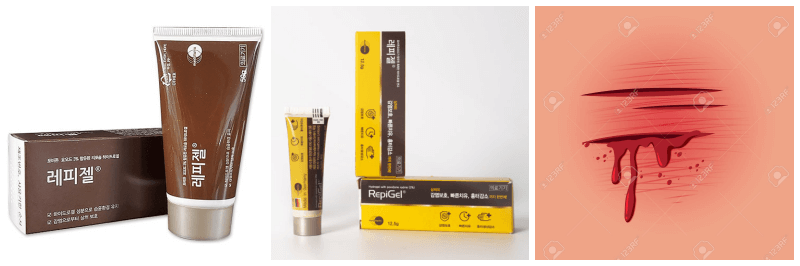 레피젤 연고 사진, 상처 일러스트