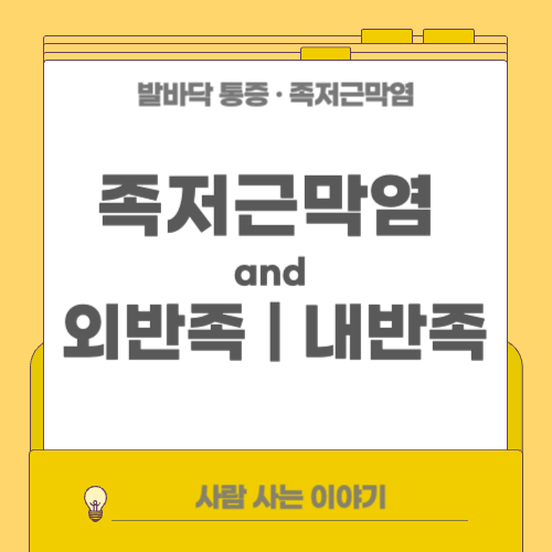 족저근막염과 외반족/내반족: 체중 분산 문제로 인한 통증