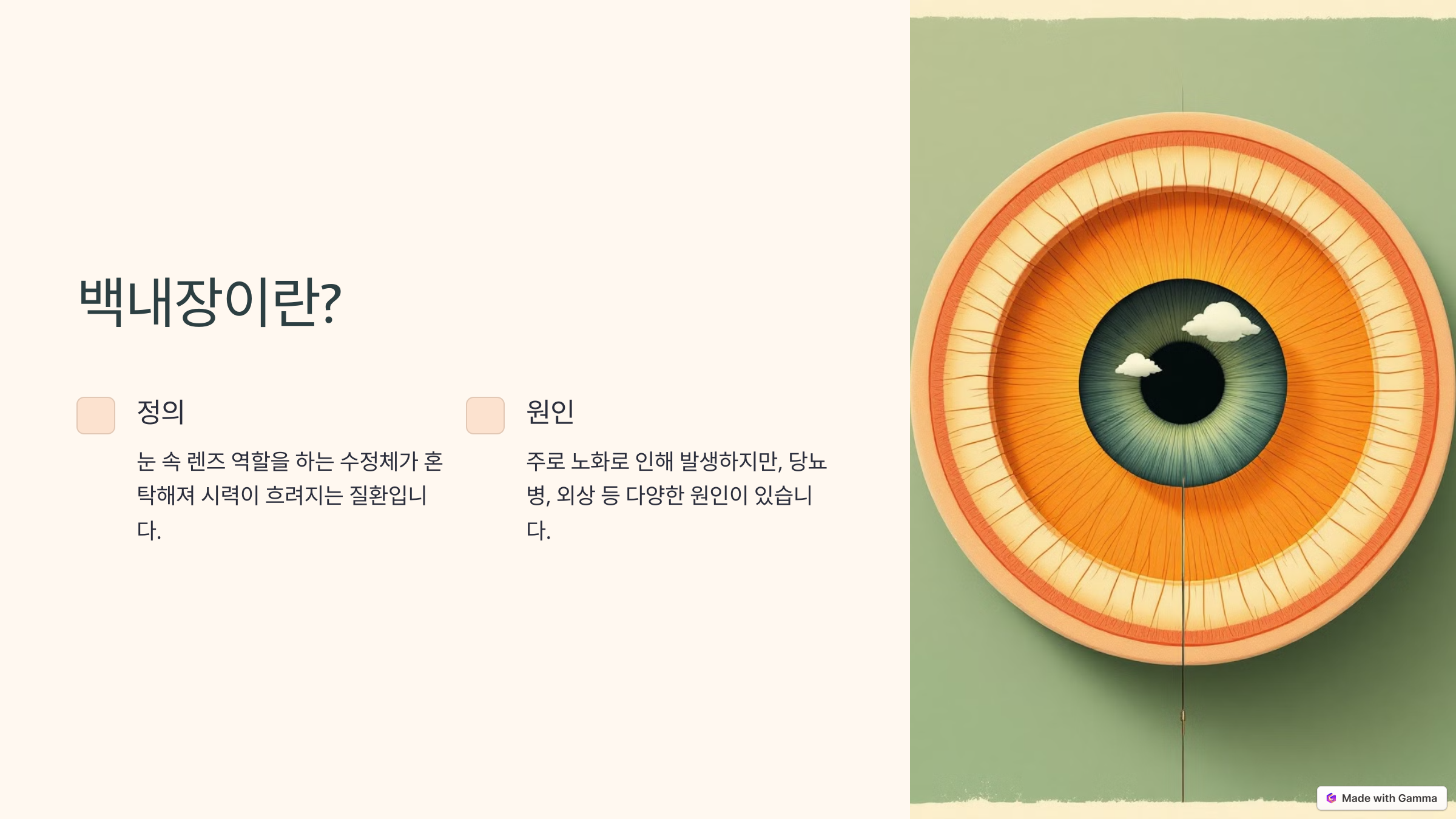 백내장 증상