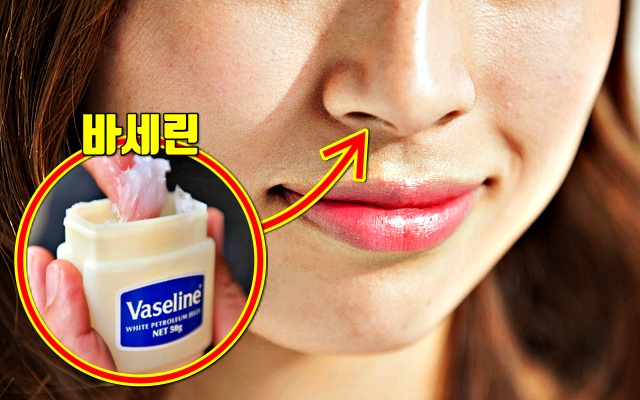 코 건조할때 바세린 효능,코속이 헐었을때 후시딘 연고