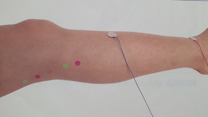 tibialis anterior 자극주는 위치