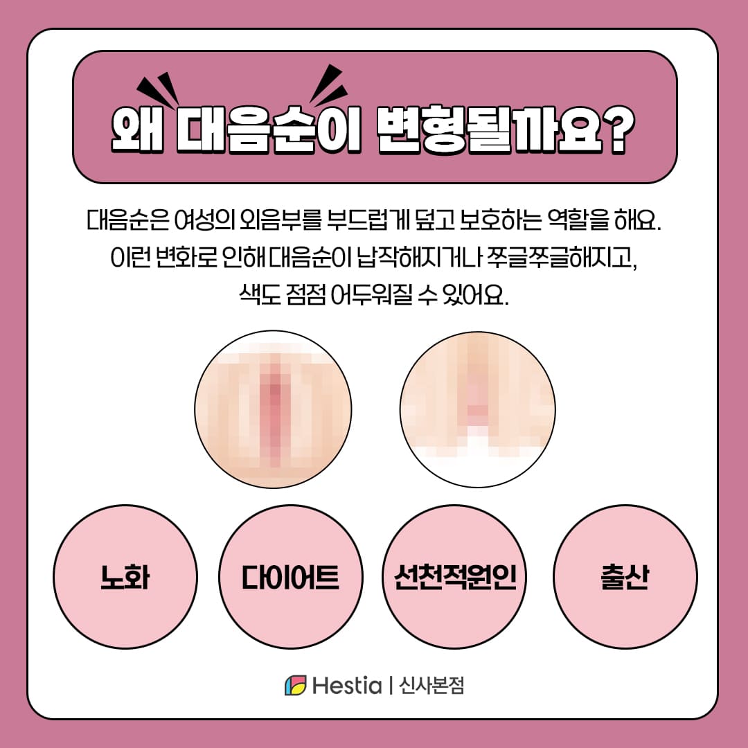 외음부 간지러움 착색, 왜 생기나요?