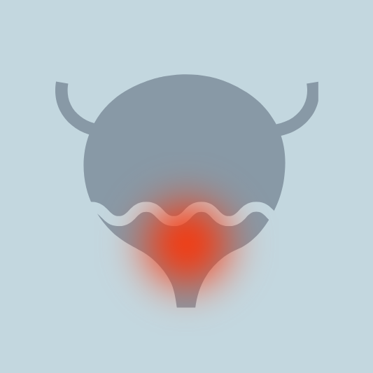 방광염-이미지-예시