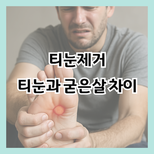 티눈제거