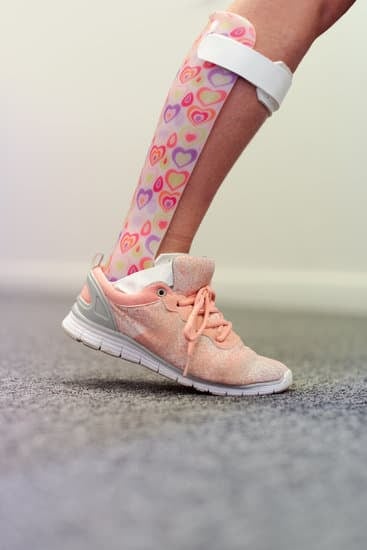 발목 유합술 (Ankle Fusion, 발목 관절 고정술) – 수술 방법 & 회복 과정