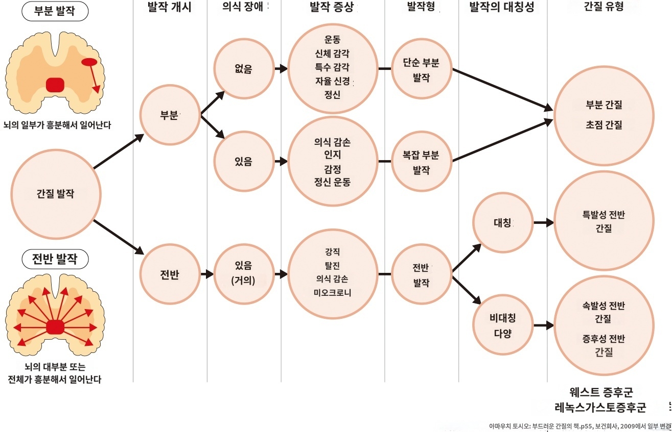 뇌전증 간질