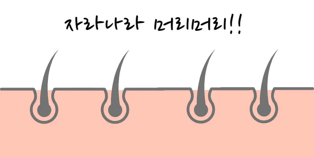 탈모-도움-머리