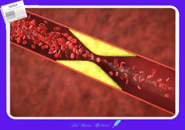 콜레스테롤 수치 변화: 이번 실험에서는 혈중 콜레스테롤 수치가 감소하였고, 특히 LDL(저밀도 지단백) 콜레스테롤 수치가 낮아진 점이 주목할 만하다.