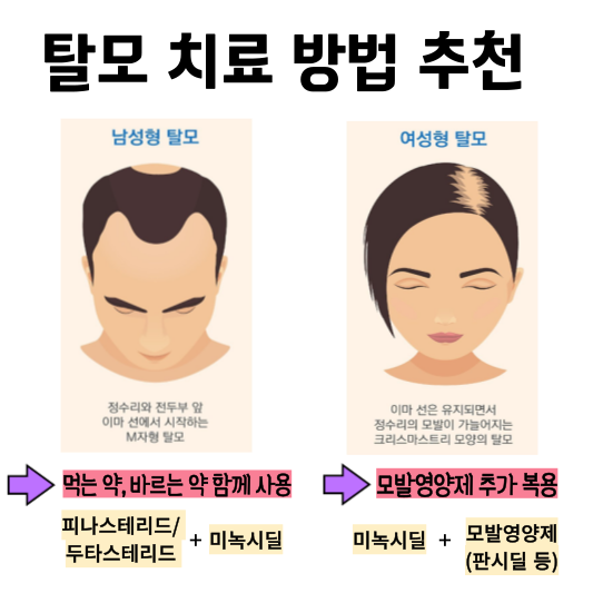 탈모 치료 방법