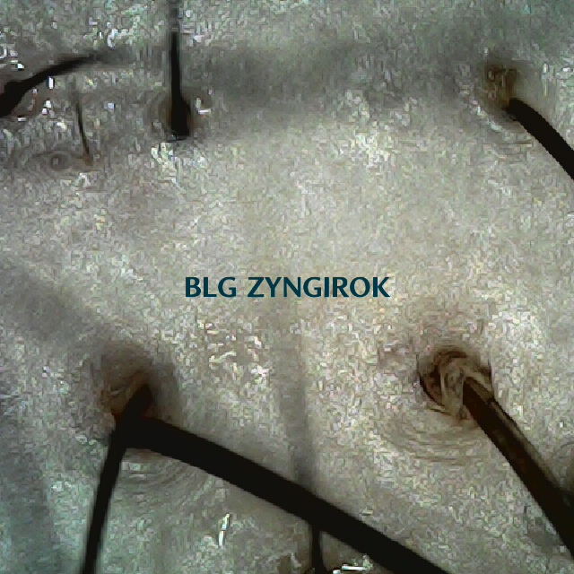 탈모 극복 프로젝트 - 정수리와 이마 사이 두피 모습이다.