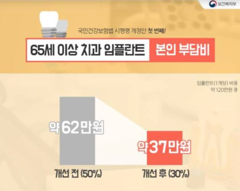 치과 임플란트 보험 혜택-만 65세 본인부담금