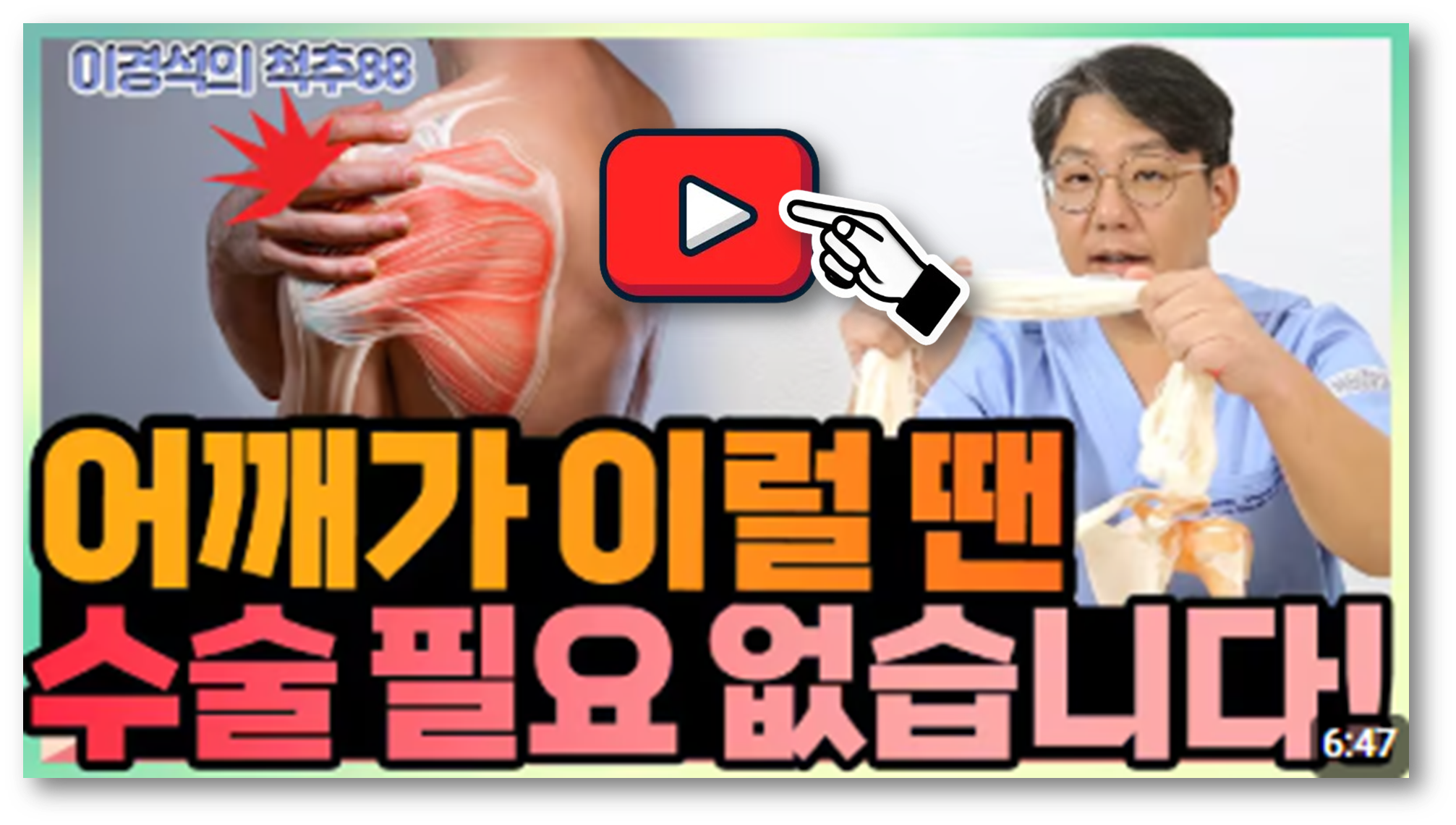 어깨 인대 끊어짐