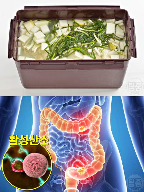 동치미 국물 효능,과식 후 활성산소 제거 대장암 예방