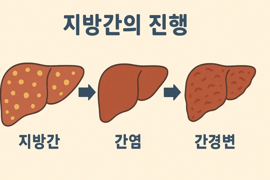 간경화 증상