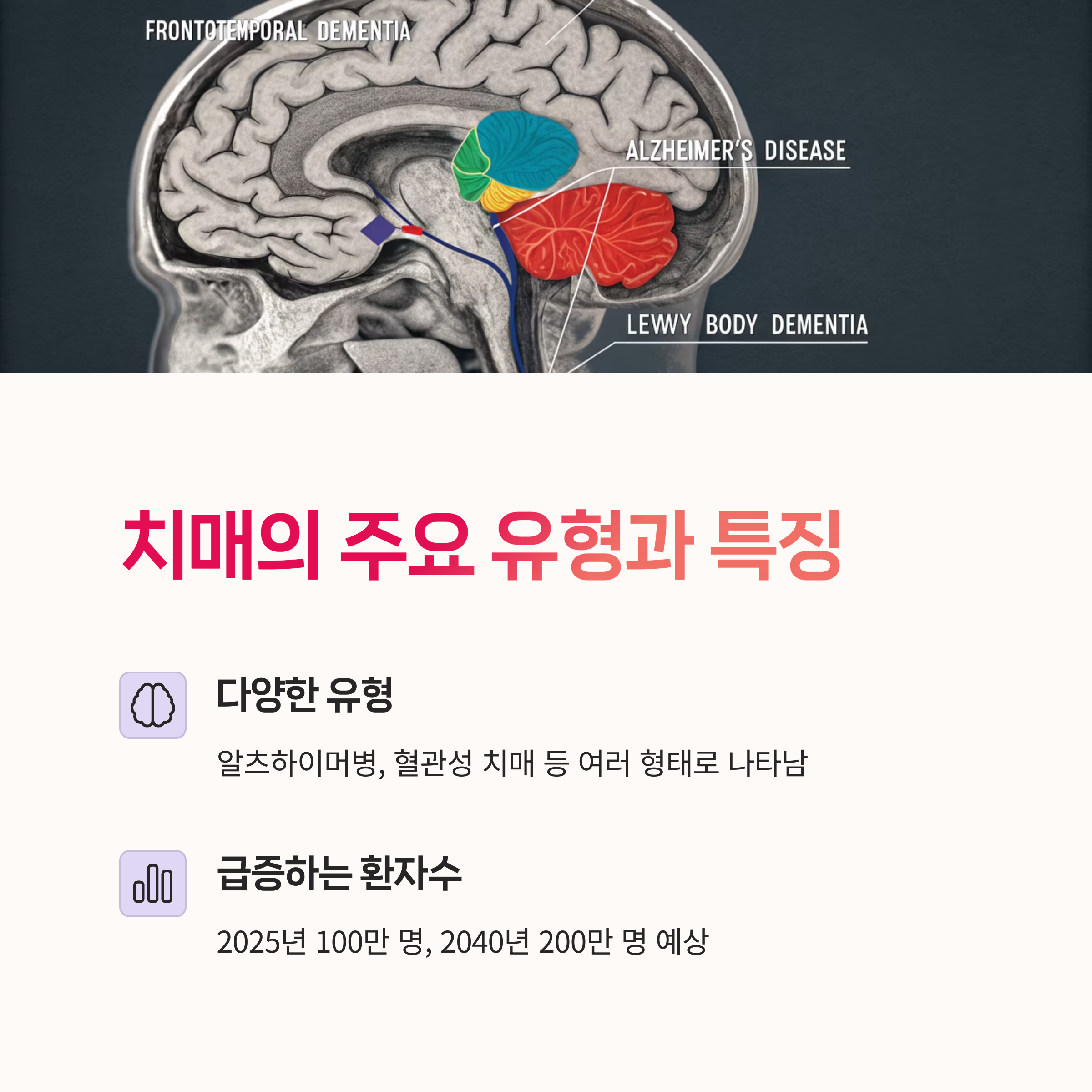 비약물치료, 노인건강,