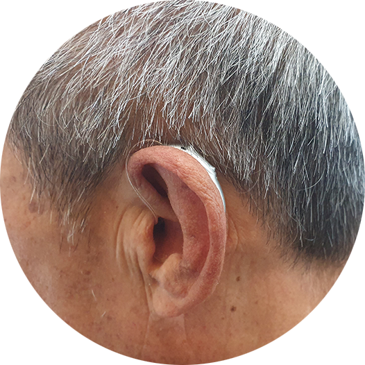 포낙보청기 착용한 고객 모습