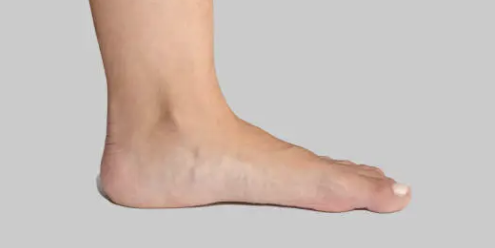 발바닥 통증부위