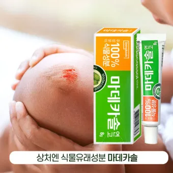 후시딘과 마데카솔 차이와 상처별 추천 사용법까지 정리한 내용_13