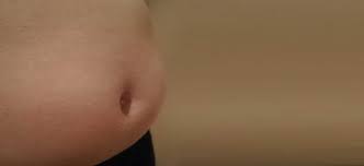 비만