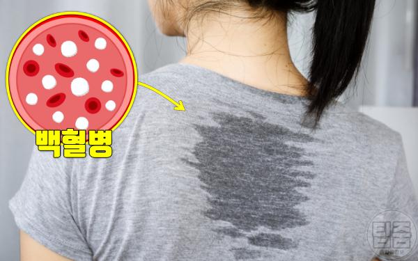 혈액암 증상 땀