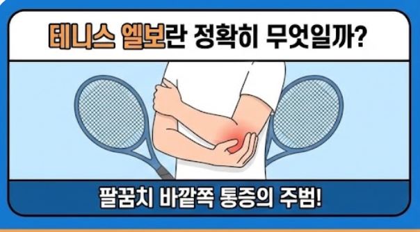 테니스 엘보 치료법