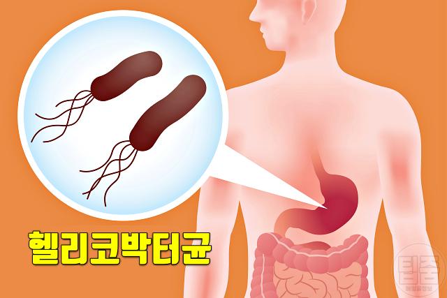 위가 부은 느낌 위가 붓는 이유 헬리코박터