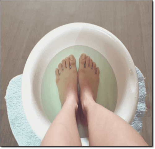 지간신경종 가정요법