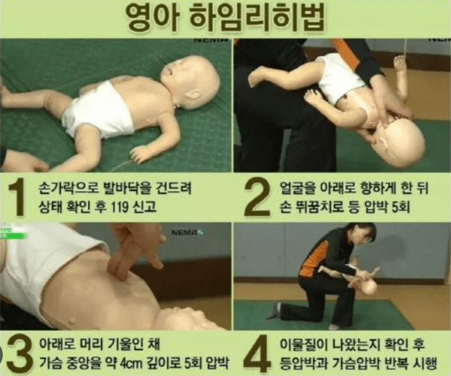 영아 기도폐쇄 시 응급처치하는법 (하임리히법) 4단계 사진