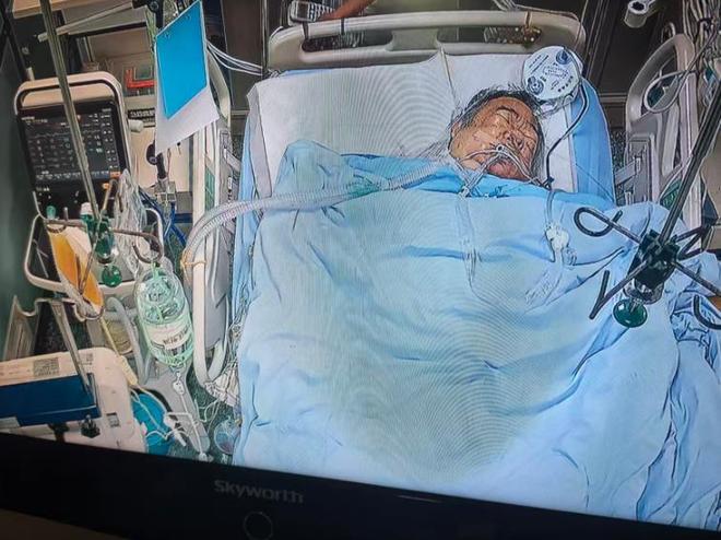 60세 가장, 비명 들리자 뛰쳐나가 흉기 난동 막다… 흉부 5곳 찔려 중환자실 사투