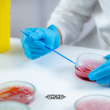 혈뇨가 나오는 이유