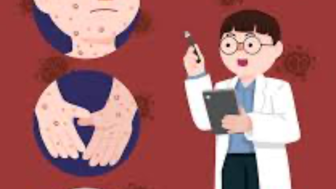 엠폭스-증상사진-감염경로